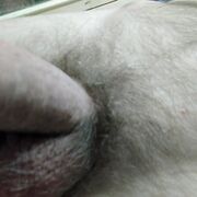 Varyss